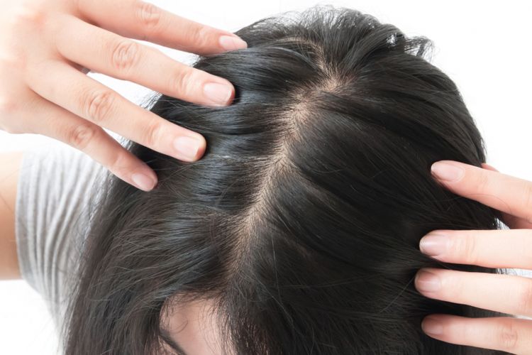 5 Cara Merawat Rambut Tipis Agar Tampak Lebih Sehat Halaman all - Kompas.com